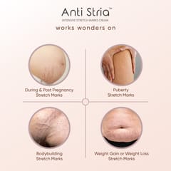 ANTI STRIA™ Stretch Marks Cream for Women & Pregnancy | Lactic Acid & Shea Butter | Once-a-Day Application | Recommended by 100+ OBGYNs & Dermatologists | Pregnancy-Safe, Retinol-Free